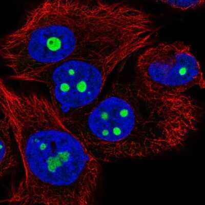 Immunocytochemistry/ Immunofluorescence: MGC20410 Antibody [NBP2-38963]