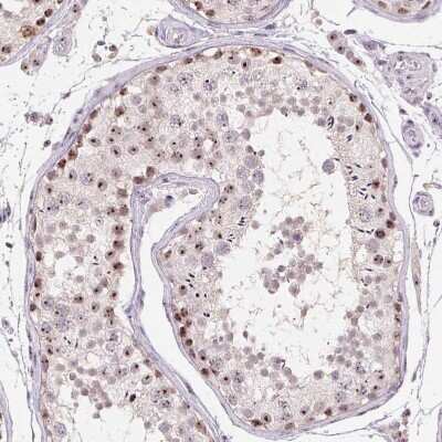 Immunocytochemistry/ Immunofluorescence: MGC20410 Antibody [NBP2-38963]