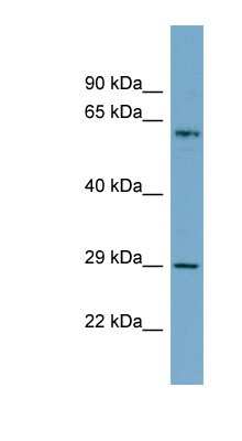 Western Blot: MGC20410 Antibody [NBP1-79268]
