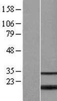 Western Blot: MGC20410 Overexpression Lysate [NBP2-05653]