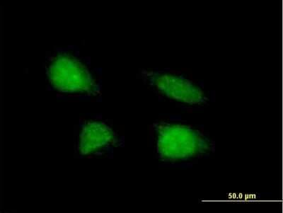Immunocytochemistry/ Immunofluorescence: MGC2803 Antibody [H00079002-B01P]