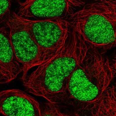 Immunocytochemistry/ Immunofluorescence: MGC2803 Antibody [NBP2-31806]