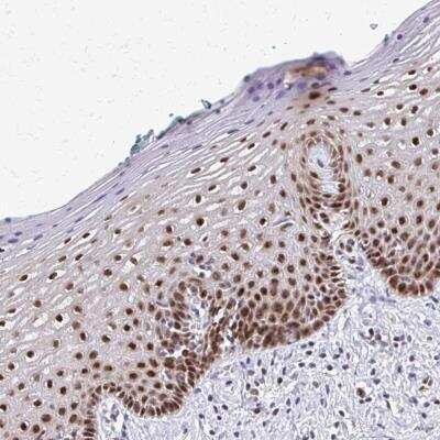 Immunohistochemistry-Paraffin: MGC2803 Antibody [NBP2-31806]