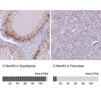 Immunohistochemistry-Paraffin: MGC2803 Antibody [NBP2-31806]