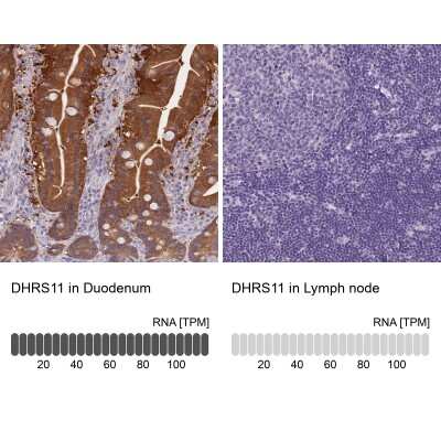 Immunohistochemistry-Paraffin: MGC4172 Antibody [NBP2-30577]