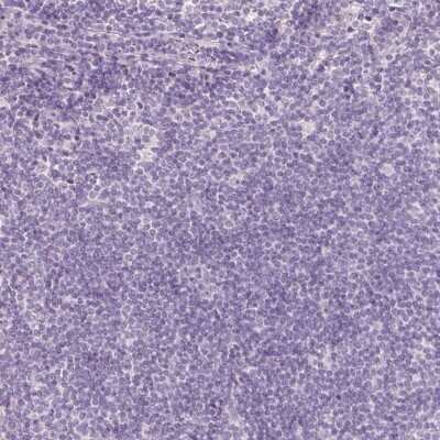 Immunohistochemistry-Paraffin: MGC4172 Antibody [NBP2-30686]