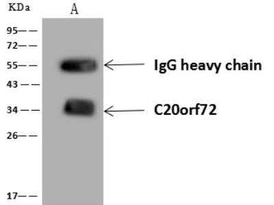 Immunoprecipitation: MGME1 Antibody [NBP3-12644]
