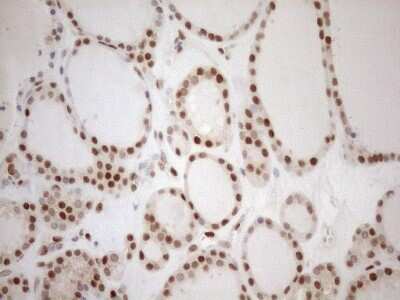 Immunohistochemistry: MGMT Antibody (OTI4F9) [NBP2-45843]