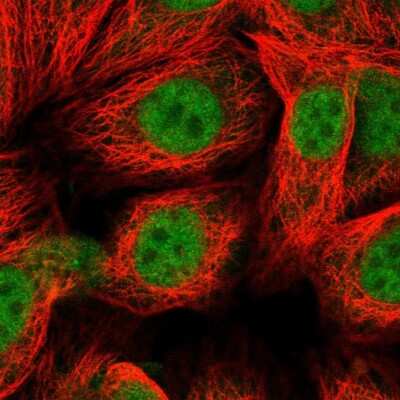 Immunocytochemistry/ Immunofluorescence: MGMT Antibody [NBP2-58612]