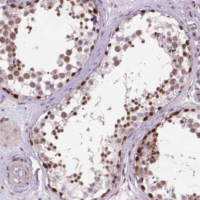 Immunohistochemistry: MGMT Antibody [NBP2-68885]