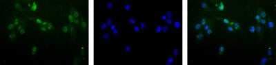 Immunocytochemistry/ Immunofluorescence: MGMT Antibody (MT 23.2) - BSA Free [NB100-168]
