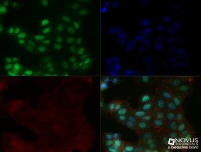Immunocytochemistry/ Immunofluorescence: MGMT Antibody (MT 23.2) - BSA Free [NB100-168]