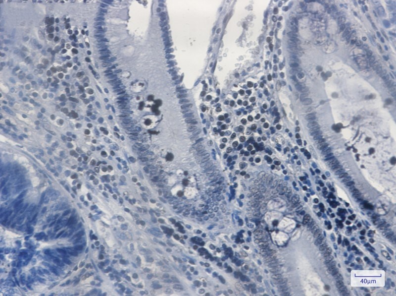 Immunohistochemistry-Paraffin: MGMT Antibody (S01-8B1) [NBP3-19480]