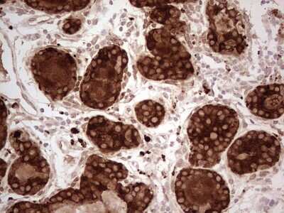 Immunohistochemistry: MGP Antibody (OTI11G6) [NBP2-45844]
