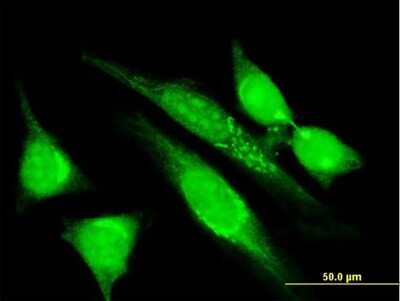 Immunocytochemistry/ Immunofluorescence: MGRN1 Antibody (3E1) [H00023295-M07]