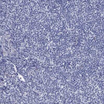 Immunohistochemistry-Paraffin: MGST3 Antibody [NBP3-17058]