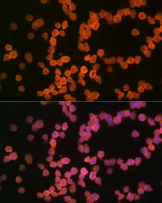 Immunocytochemistry/ Immunofluorescence: MHC Class I Antibody (3I1C1) [NBP3-16696]