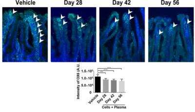 Immunohistochemistry: MHC Class II RT1B Antibody (OX-6) - BSA Free [NB100-65541]