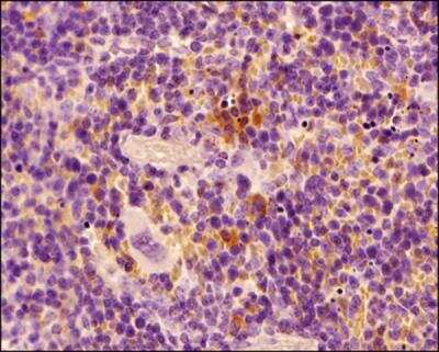 Immunohistochemistry-Paraffin: MHC Class II RT1B Antibody (OX-6) - BSA Free [NB100-65541]