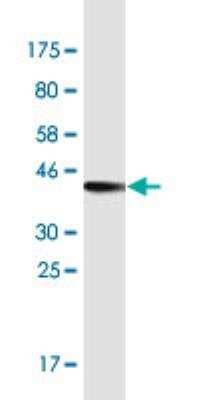 Western Blot: MIA2 Antibody (2B9) [H00117153-M09-100ug]