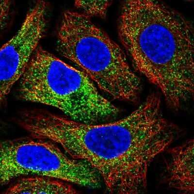 Immunocytochemistry/ Immunofluorescence: MIA3 Antibody [NBP2-33770]