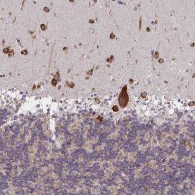 Immunohistochemistry-Paraffin: MIA3 Antibody [NBP2-33770]