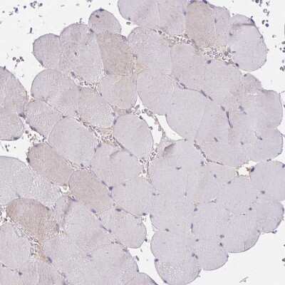 Immunohistochemistry-Paraffin: MIA3 Antibody [NBP2-33770]