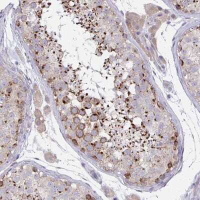 Immunohistochemistry-Paraffin: MIA3 Antibody [NBP2-33770]