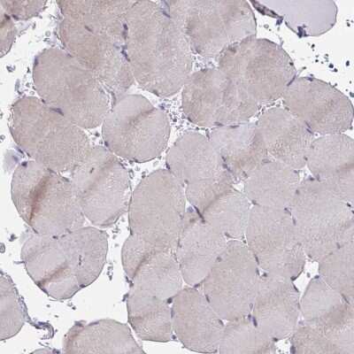 Immunohistochemistry-Paraffin: MIA3 Antibody [NBP2-34160]