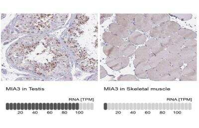 Immunohistochemistry-Paraffin: MIA3 Antibody [NBP2-34160]