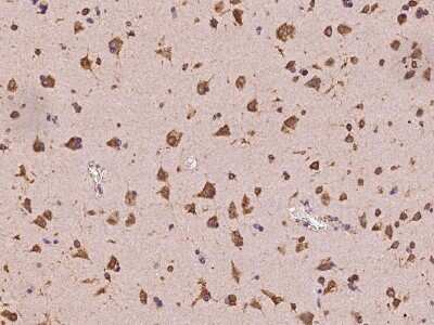 Immunohistochemistry-Paraffin: MIA3 Antibody [NBP2-98635]