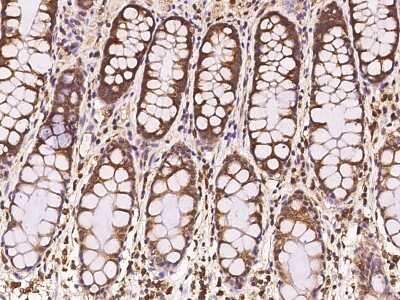 Immunohistochemistry-Paraffin: MIA3 Antibody [NBP2-98635]