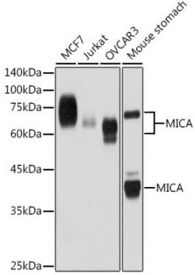 Western Blot: MICA Antibody (5A1P3) [NBP3-15719]