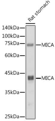 Western Blot: MICA Antibody (5A1P3) [NBP3-15719]