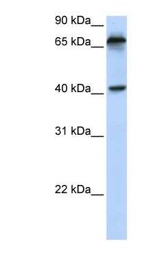 Western Blot: MICA Antibody [NBP1-59184]