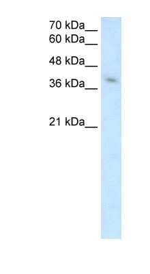 Western Blot: MICA Antibody [NBP1-59185]