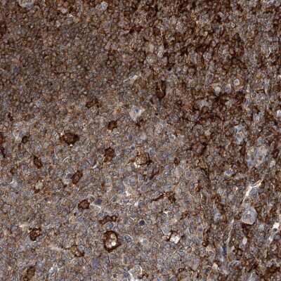 Immunohistochemistry-Paraffin: MICAL1 Antibody [NBP2-38154]