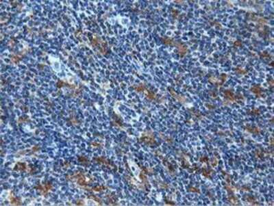Immunohistochemistry: MICAL1 Antibody (OTI6H4) - Azide and BSA Free [NBP2-72670]