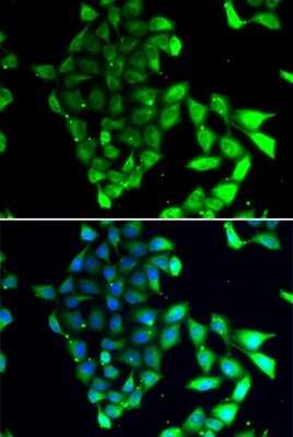 Immunocytochemistry/ Immunofluorescence: MID1 Antibody - BSA Free [NBP3-05061]