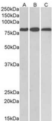 Western Blot: MID2 Antibody [NB100-1167]