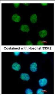 Immunocytochemistry/ Immunofluorescence: MIER3 Antibody [NBP2-17290]