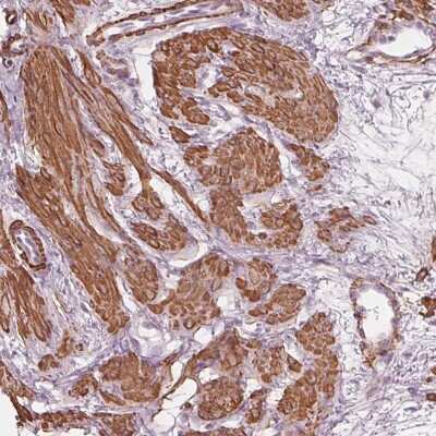 Immunohistochemistry-Paraffin: MIER3 Antibody [NBP2-38080]