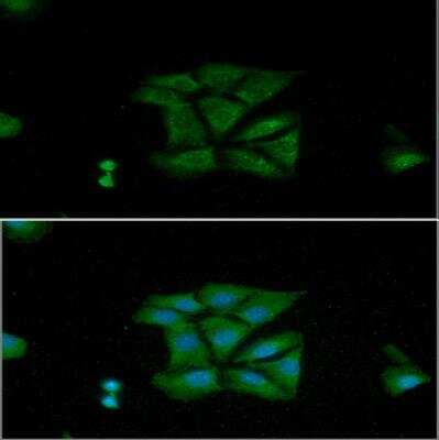 Immunocytochemistry/ Immunofluorescence: MIF Antibody (4E4) - BSA Free [NBP1-04319]
