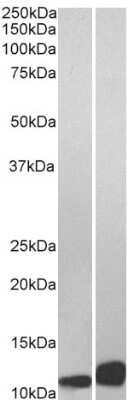 Western Blot: MIF Antibody [NB100-1789]