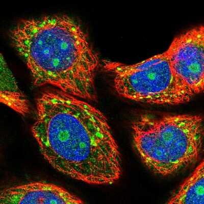 Immunocytochemistry/ Immunofluorescence: MIF4GD Antibody [NBP2-30627]