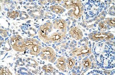Immunohistochemistry-Paraffin: MIF4GD Antibody [NBP1-57562]