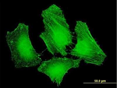 Immunocytochemistry/ Immunofluorescence: MIG2/Kindlin-2 Antibody (2G11) [H00010979-M09]