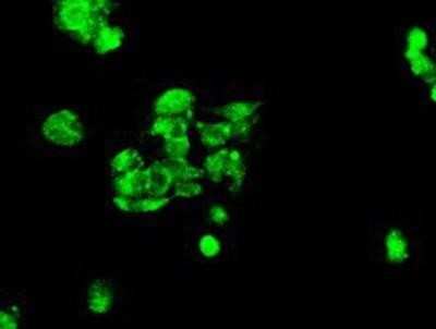 Immunocytochemistry/ Immunofluorescence: MIG2/Kindlin-2 Antibody (OTI9E4) [NBP1-47745]