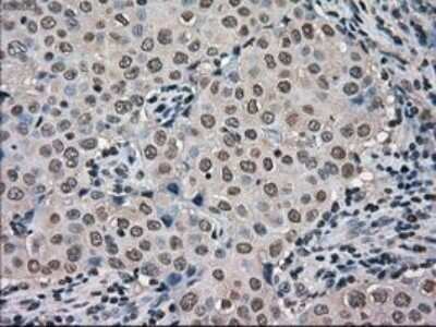 Immunohistochemistry-Paraffin: MIG2/Kindlin-2 Antibody (OTI9E4) [NBP1-47745]