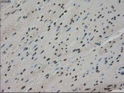 Immunohistochemistry-Paraffin: MIG2/Kindlin-2 Antibody (OTI9E4) [NBP1-47745]